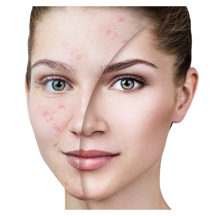 ⁦Sephora Beauty Touch mask 50ml Gomme ماسك تنقية البشرة بخلاصة النعناع⁩ - الصورة ⁦4⁩