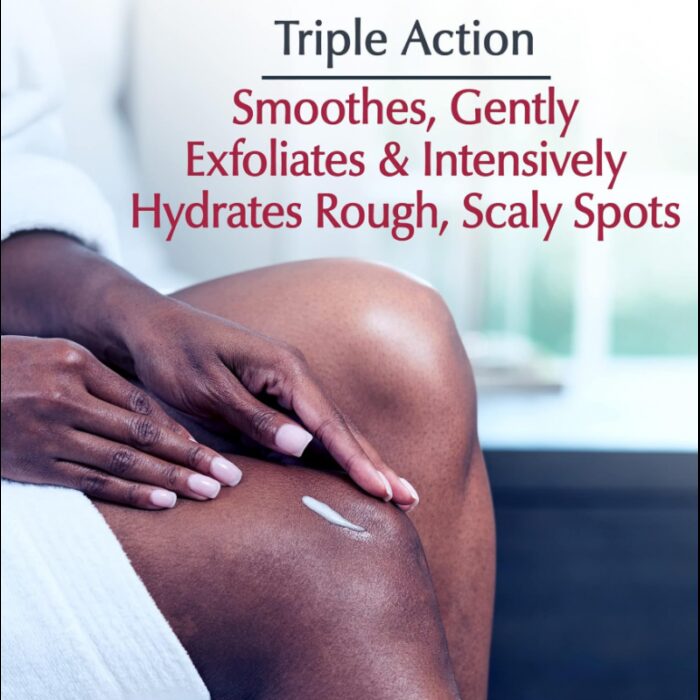 ⁦كريم علاج القضاء على البقع الخشنة من يوسرين حجم 71 غم -Eucerin Roughness Relief Spot Treatment Fragrance Free By Eucerin 71g⁩ - الصورة ⁦2⁩