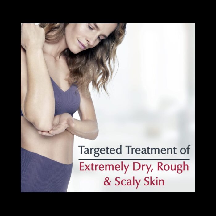 ⁦كريم علاج القضاء على البقع الخشنة من يوسرين حجم 71 غم -Eucerin Roughness Relief Spot Treatment Fragrance Free By Eucerin 71g⁩ - الصورة ⁦3⁩