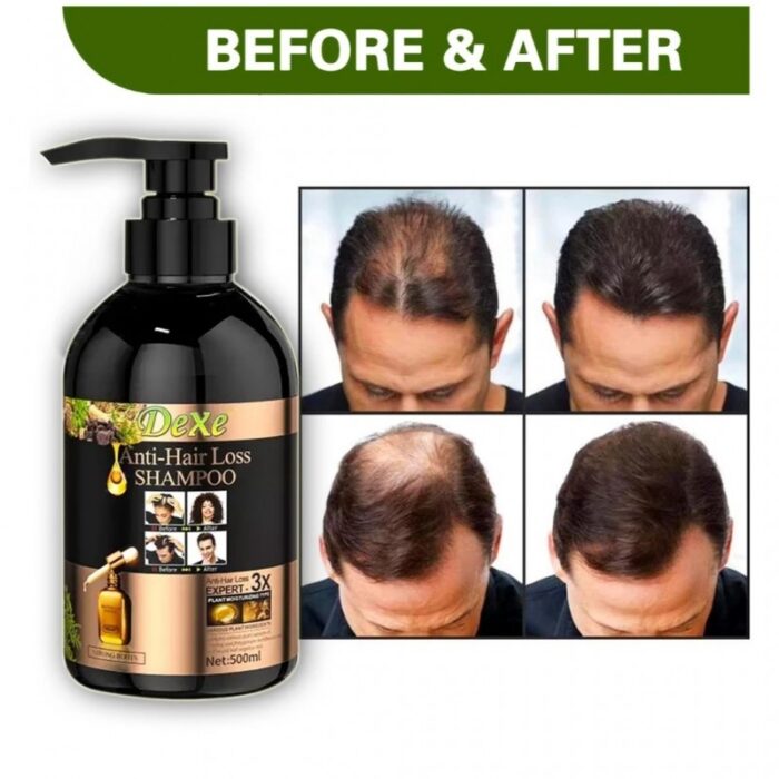 ⁦شامبو منع تساقط الشعر DEXE 500 ML⁩ - الصورة ⁦7⁩
