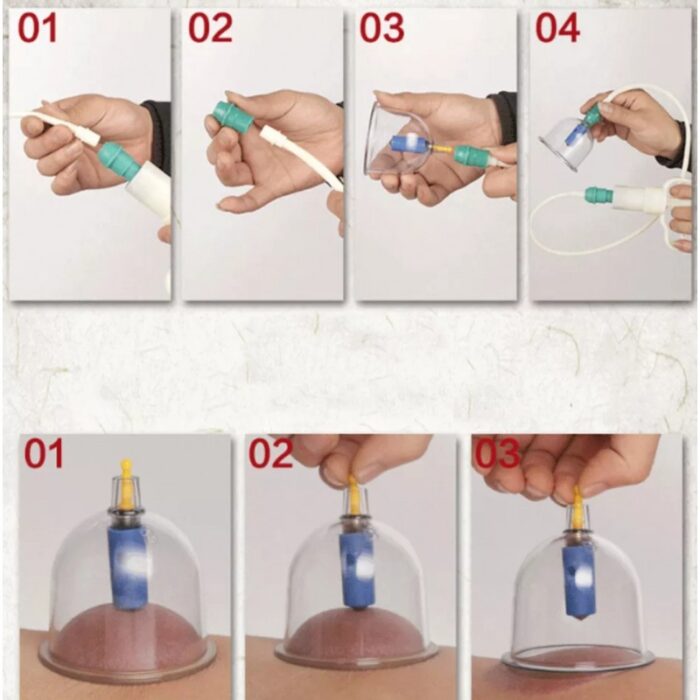 10321543_67fabad6aeeae طقم الحجامة 0073 - الصورة 1