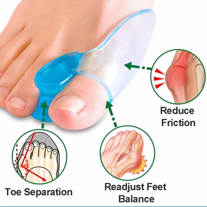 ⁦رباط سيليكون طبي لتعديل أصابع القدم - عدد 2⁩ - الصورة ⁦1⁩