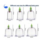 الحجامة الاسلامية