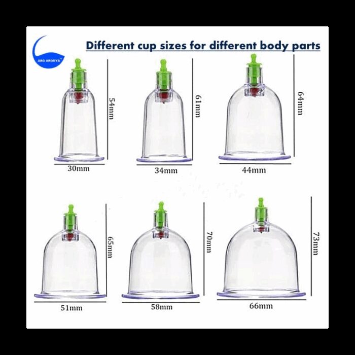 ⁦الحجامة الاسلامية⁩ - الصورة ⁦1⁩